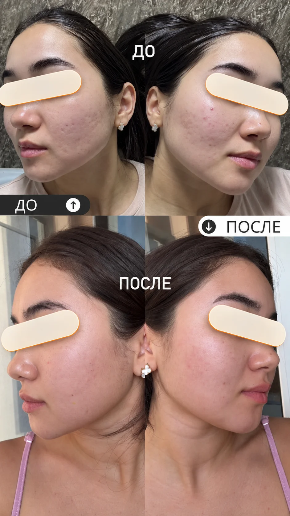 Результат после подбора ухода LULU