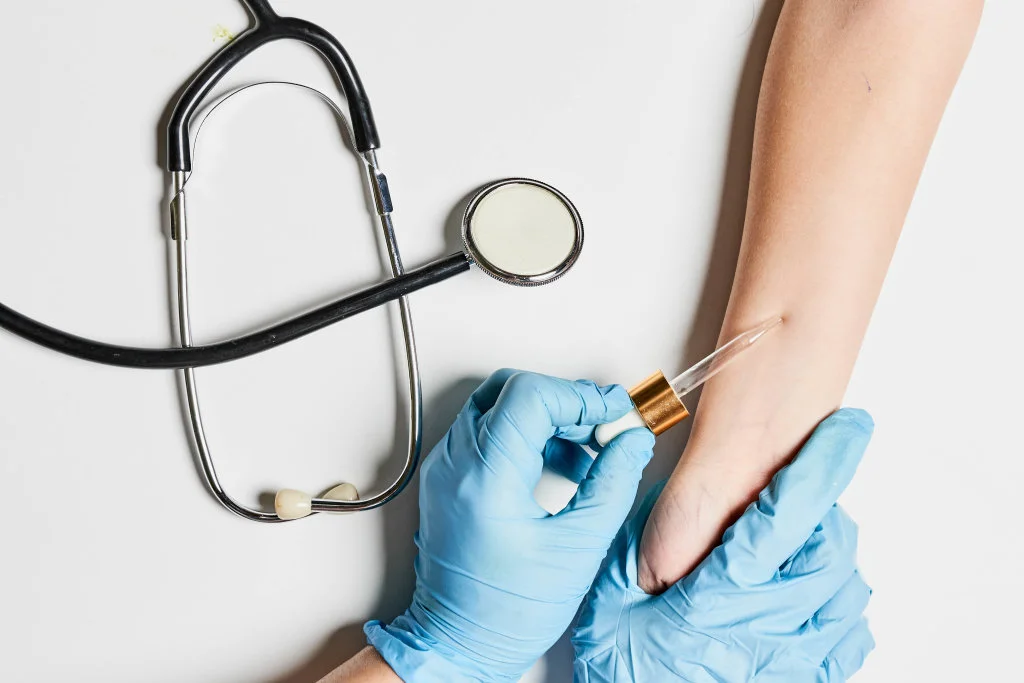 Аллергодиагностика