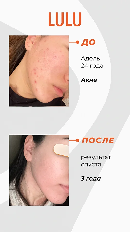 Результат после подбора ухода LULU