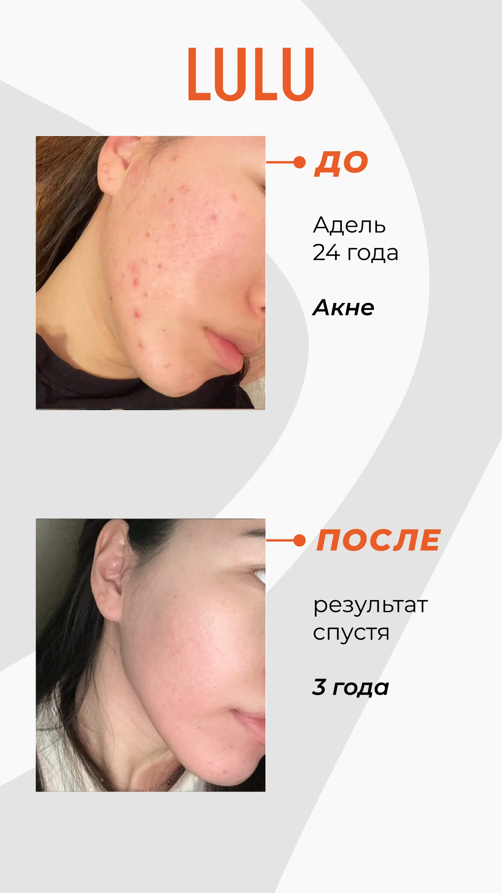 Результат после подбора ухода LULU