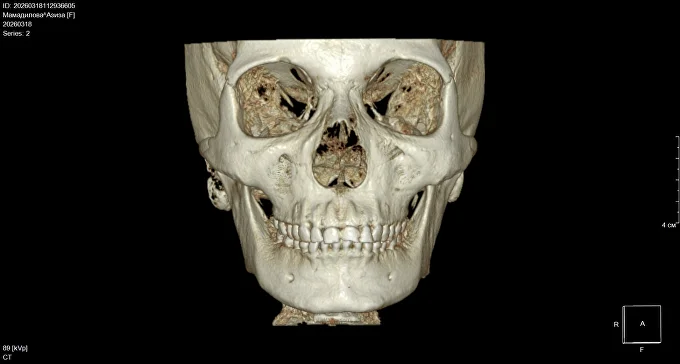 КЛКТ DICOM