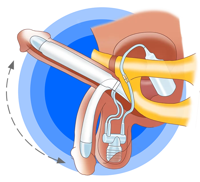 Олар кискаға не салады?